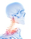 Painful cervical spine Royalty Free Stock Photo