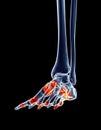 Painful foot joints Royalty Free Stock Photo
