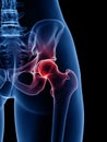 A painful hip joint Royalty Free Stock Photo