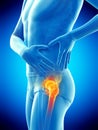 Painful hip joint