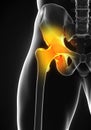 Painful Hip Joint