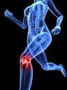 Painful knee Royalty Free Stock Photo