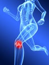 Painful knee Royalty Free Stock Photo