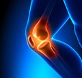 Painful Knee Close-up Royalty Free Stock Photo