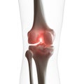 A painful knee Royalty Free Stock Photo