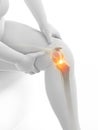 Painful knee joint