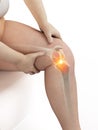 Painful knee joint