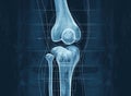 Painful knee joint. Medically artwork concept Royalty Free Stock Photo