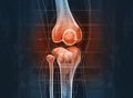 Painful knee joint. Medically artwork concept