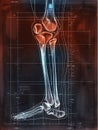 Painful knee joint. Medically artwork concept Royalty Free Stock Photo