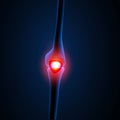 Painful Knee or leg X-ray Royalty Free Stock Photo