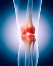 The painful knee Royalty Free Stock Photo