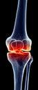 Painful knee Royalty Free Stock Photo