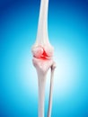 Painful knee Royalty Free Stock Photo