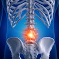 A painful lumbar spine