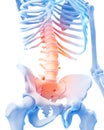 Painful lumbar spine Royalty Free Stock Photo