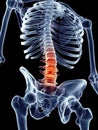 Painful lumbar spine Royalty Free Stock Photo