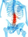 Painful lumbar spine