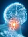 A painful neck Royalty Free Stock Photo