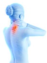 Painful neck - visible spine Royalty Free Stock Photo