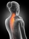 Painful neck - visible spine Royalty Free Stock Photo