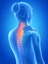 Painful neck Royalty Free Stock Photo