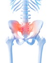 Painful sacrum