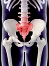 The painful sacrum