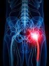 painful sciatic nerve Royalty Free Stock Photo