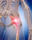 Painful sciatic nerve Royalty Free Stock Photo