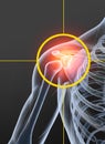 Painful shoulder joint, medically illustration with a target Royalty Free Stock Photo