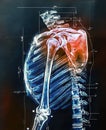 Painful shoulder joints. Shoulder anatomy. Frozen shoulder. Impingement. Concept illustration