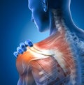 Painful shoulder joints. Frozen shoulder, Impingement. 3D illustration