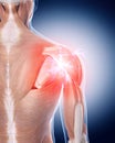 Painful shoulder Royalty Free Stock Photo