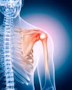 Painful shoulder Royalty Free Stock Photo