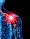 Painful shoulder Royalty Free Stock Photo