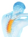 A painful upper back