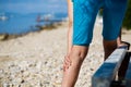 Painful varicose veins Royalty Free Stock Photo