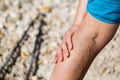 Painful varicose veins