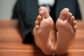 A pair of feet the skin detaches due to eczema