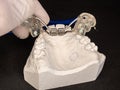 Palatal expander for the maxilla, setting test