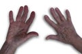 Hands of an elderly woman with osteoarthritis. Top view white background