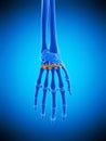 The palmar metacarpal ligaments