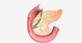 The pancreas is a digestive organ that helps break down food and