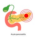 Pancreas disease and cancer