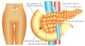 Pancreas