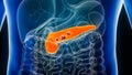 Pancreas or pancreatic cancer with organs and tumors or cancerous cells 3D rendering illustration with male body. Anatomy,