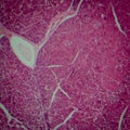 Pancreas tissue