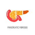 Pancreatic fibrosis concept. Vector illustration