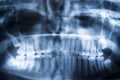Panoramic Dental X-Ray Of Human Teeth Royalty Free Stock Photo